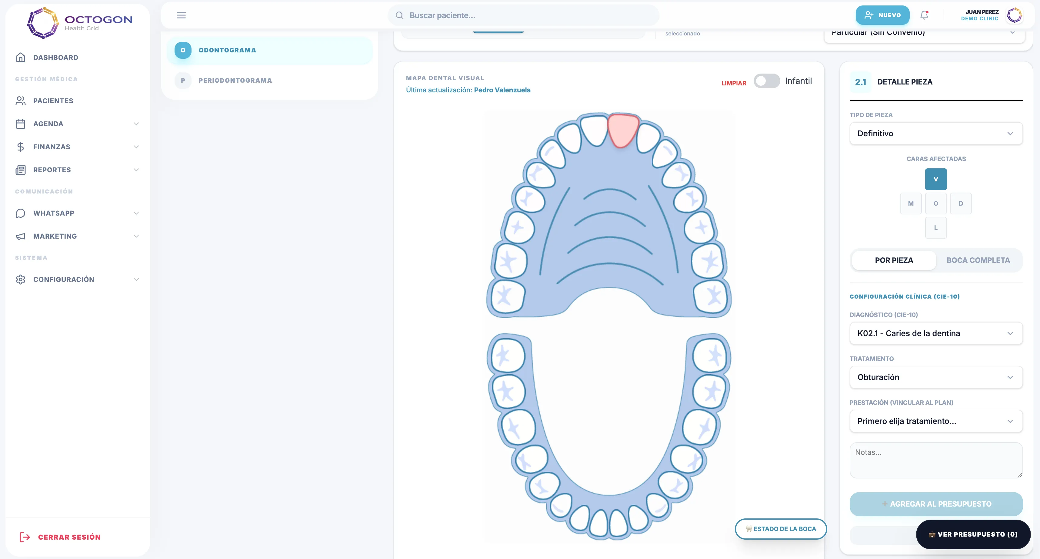 Software dental Octogon - Odontograma evolutivo con diagnóstico CIE-10