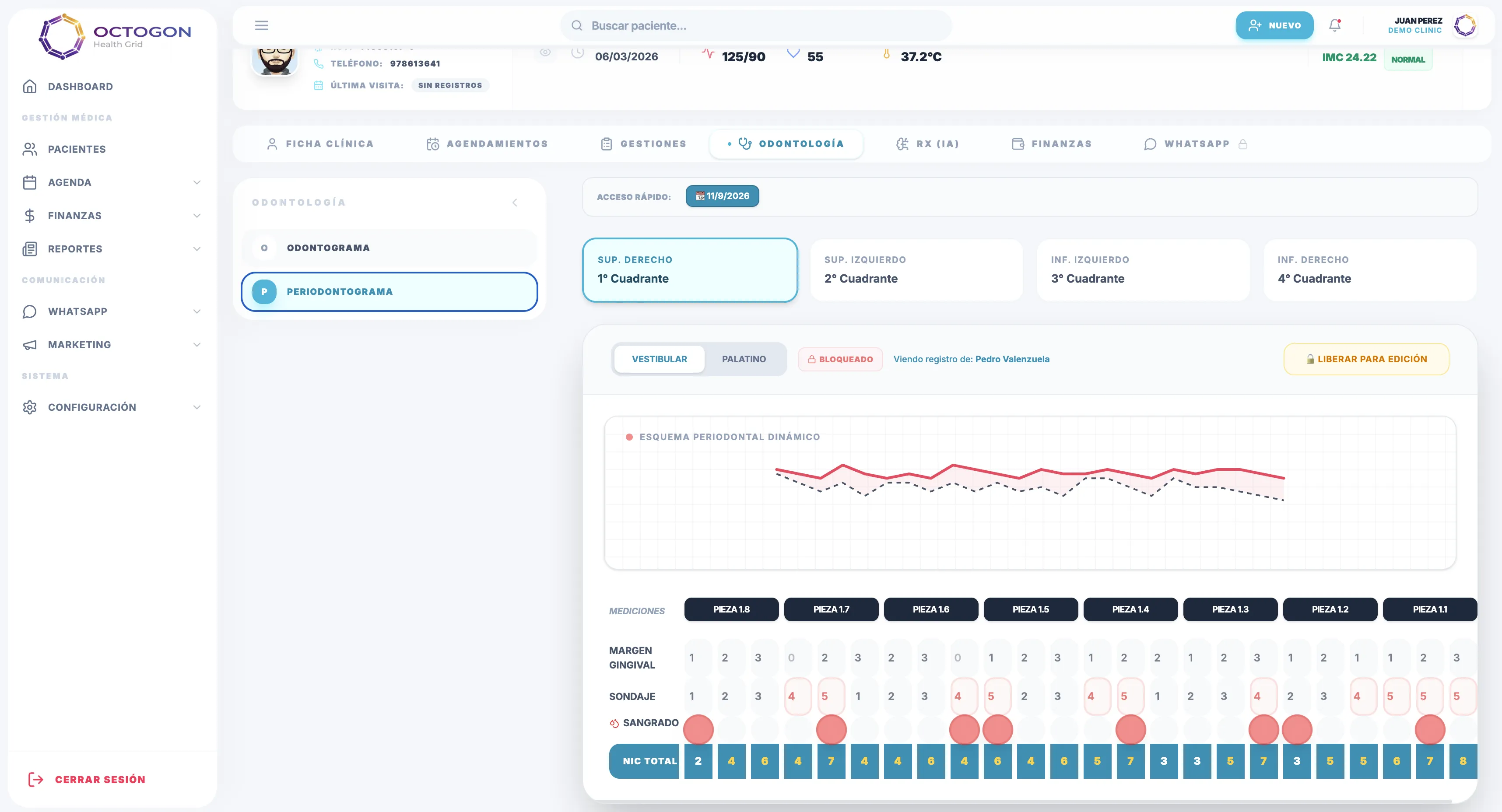 Software dental Octogon - Periodontograma dinámico por cuadrante