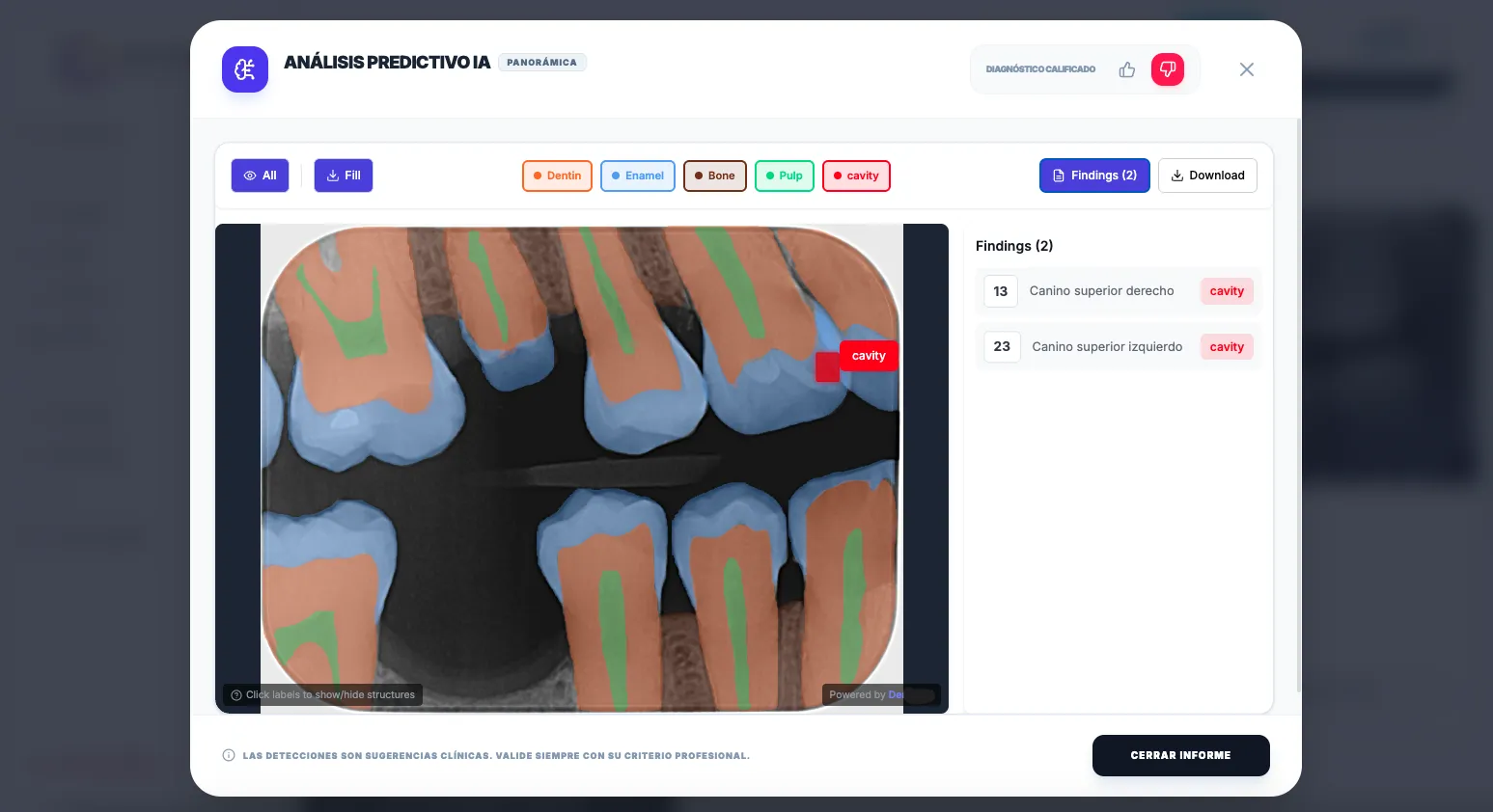 Software dental Octogon - IA para análisis de radiografías